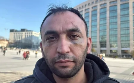 İstanbul'da Akılalmaz Tuzak: Sevgilisinin Evinde Darp ve Gasp Kamerada!