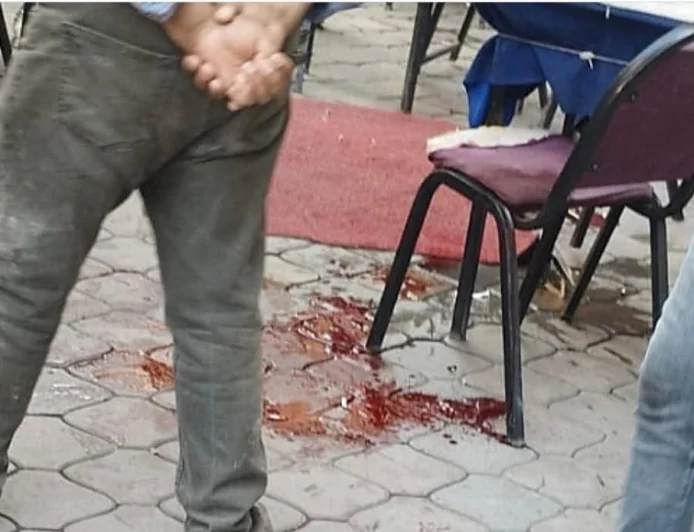 Iğdır Söğütlü Mahallesi’nde Kavga: Yaralılar Hastaneye Kaldırıldı